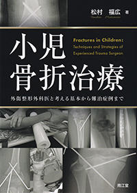 小児骨折治療