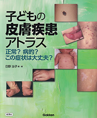 子どもの皮膚疾患アトラス