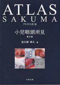 アトラスさくま　小児咽頭所見　第2版