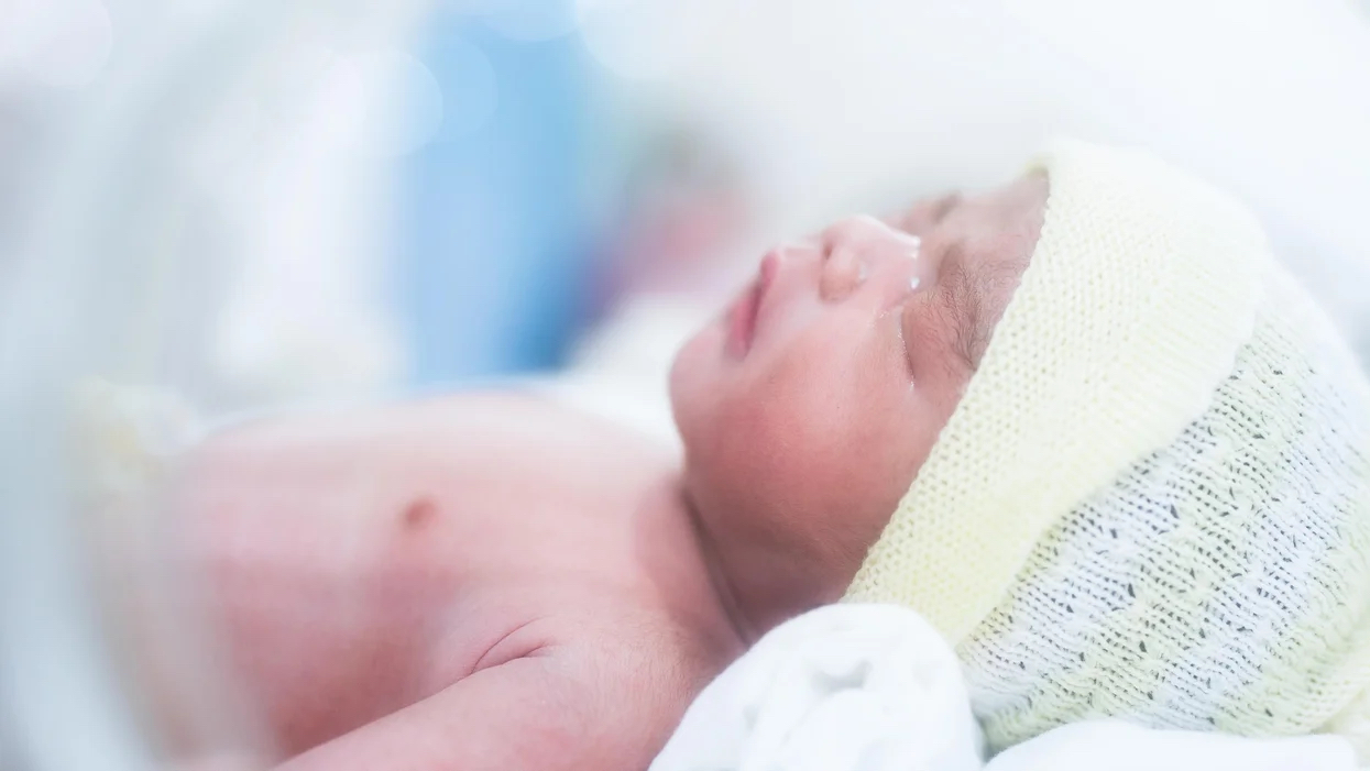 『米国小児科学会が新生児高ビリルビン血症の管理に関するガイドラインを改訂』のイメージ